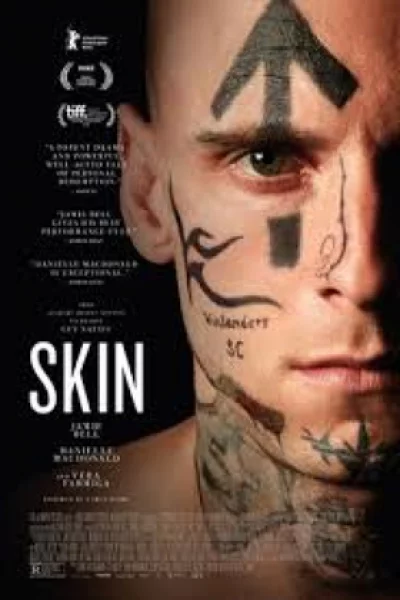Skin (2018) เต็มเรื่อง